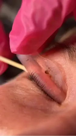 Lash lifting