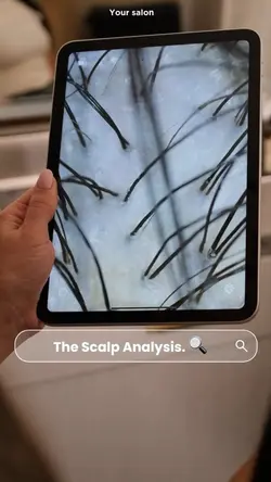 Scalp Analysis My