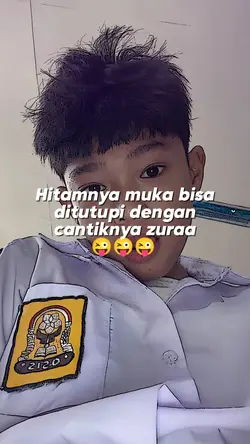Hitamnya muka bisa d