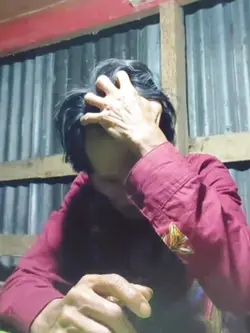 adu kepala nyut-nyut