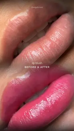 Lip before after PMU