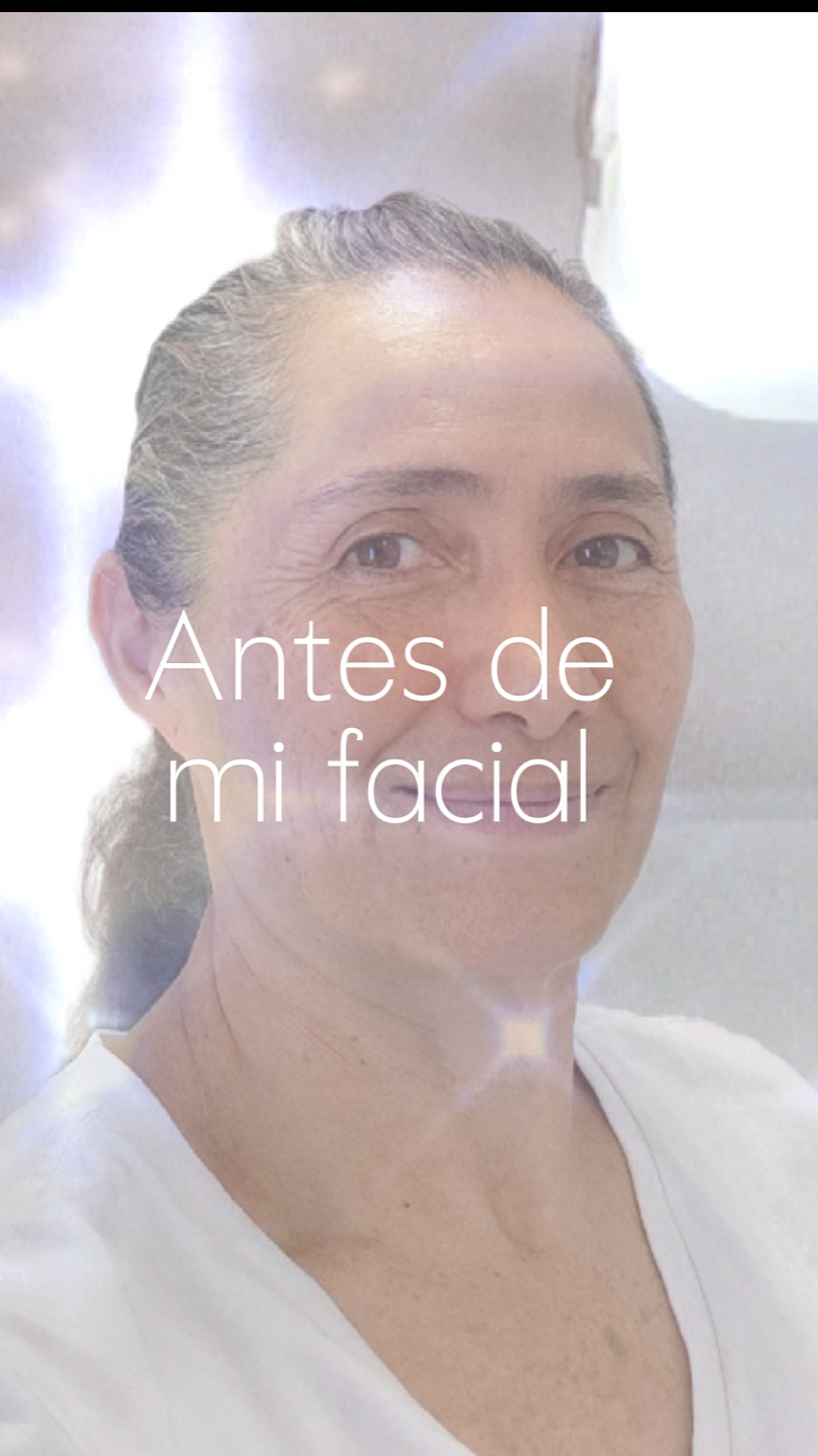 Facial