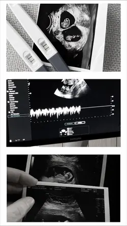 Pregnant🫶🏻