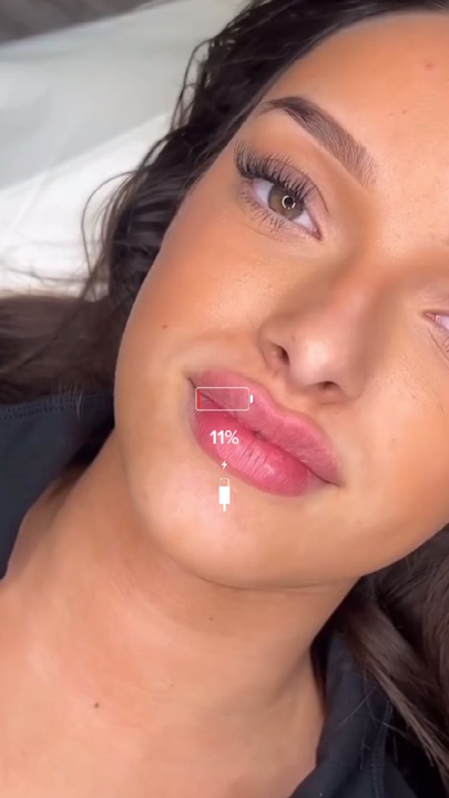Microneedling aesthe