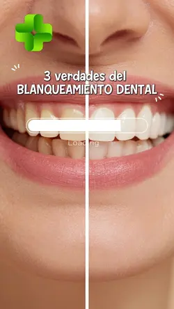 Blanqueamiento denta
