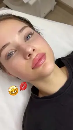 LIPFILLER aesthetic
