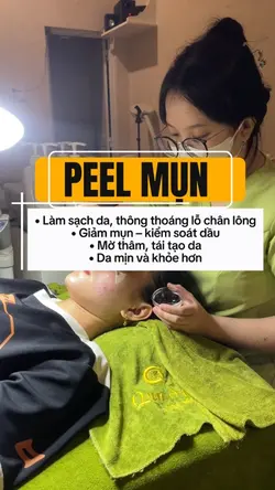 Peel mụn 