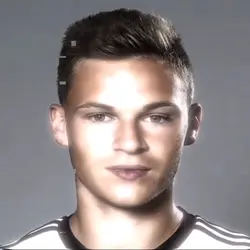 Kimmich Edit