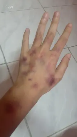 injury prank AI