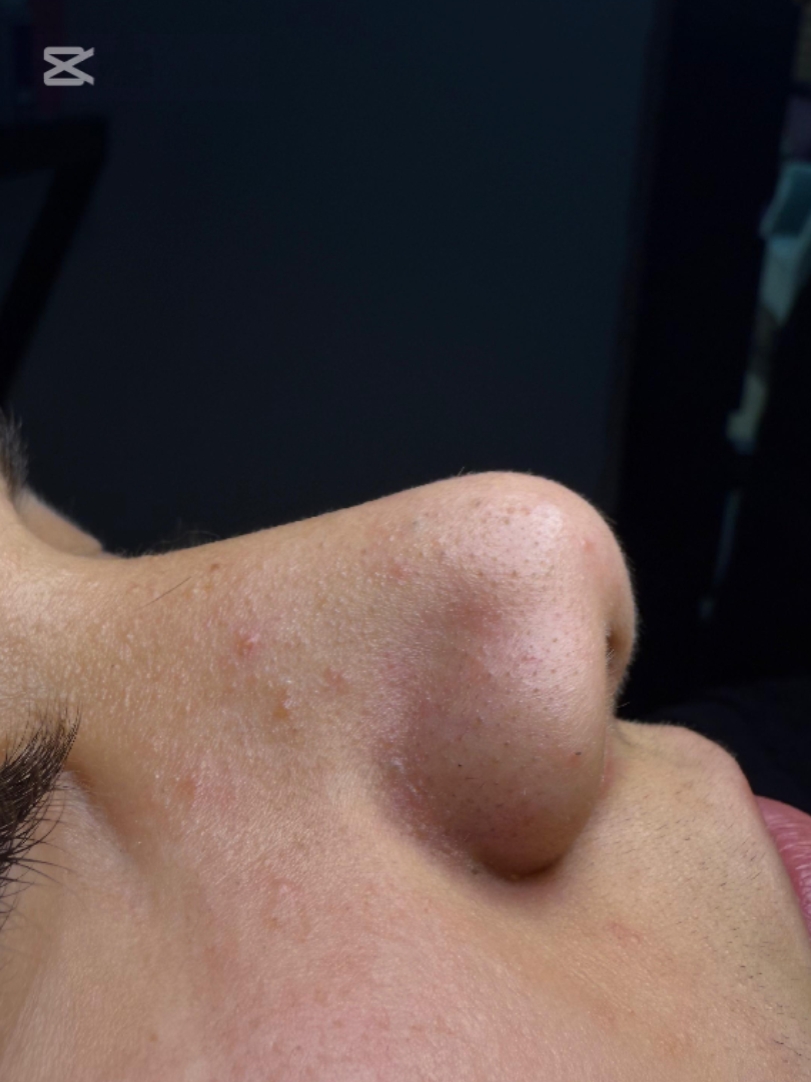 skin before after 