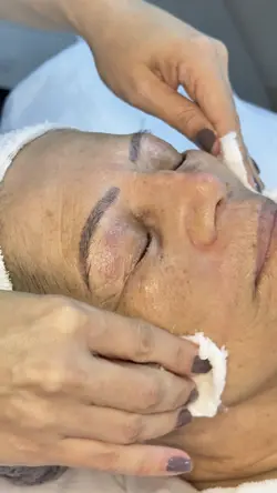 Limpeza de pele