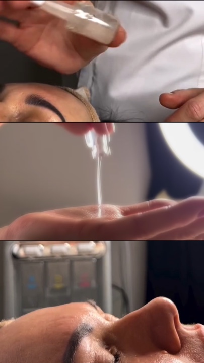 Microagujas