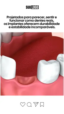 implante dentário