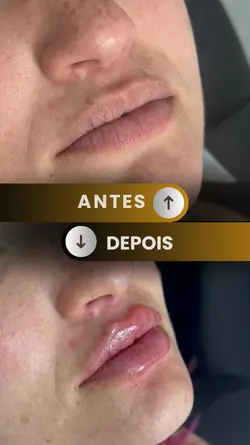 ANTES E DEPOIS