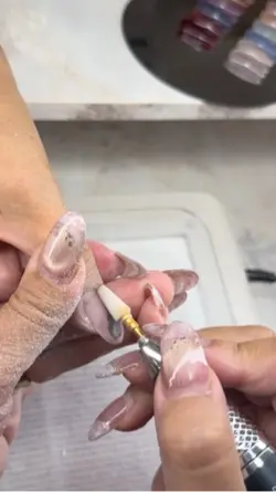 フィルインの接地面