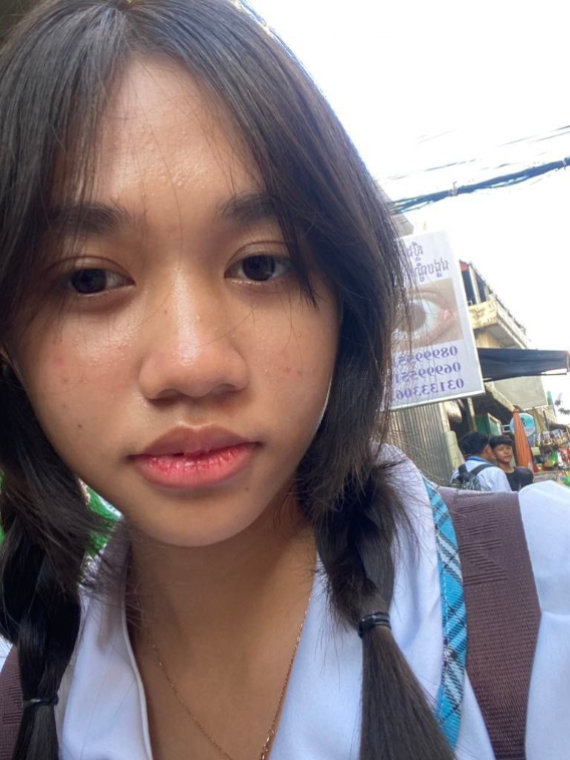 អន់គ្រប់យ៉ាង..