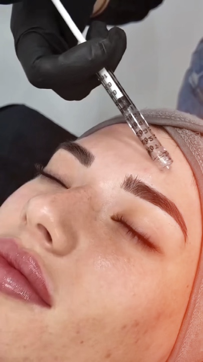 Microneedlingaesthet