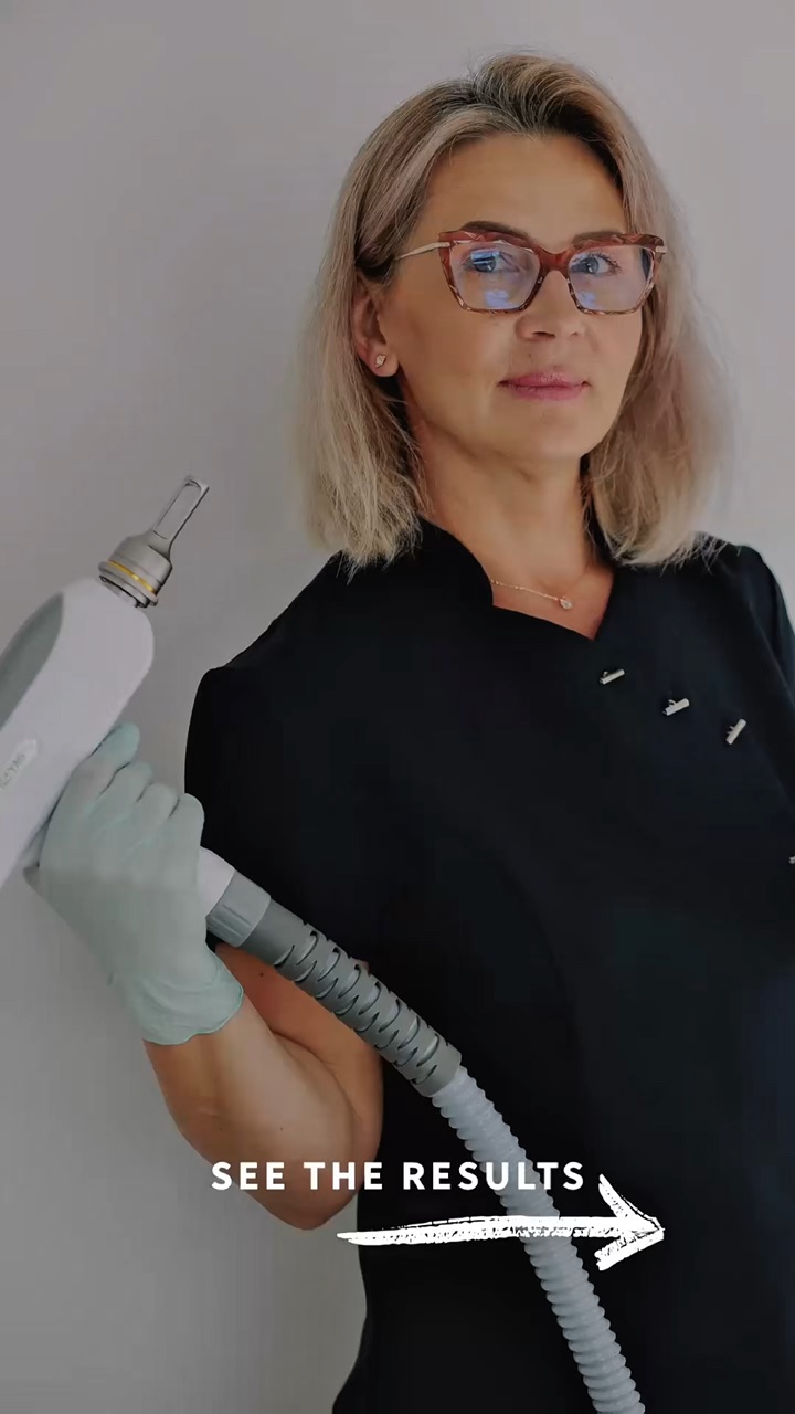 Remoção De Tatuagem A Laser