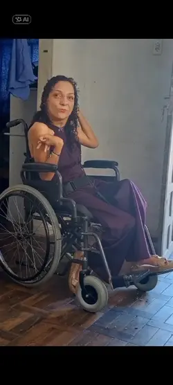 antes e depois
