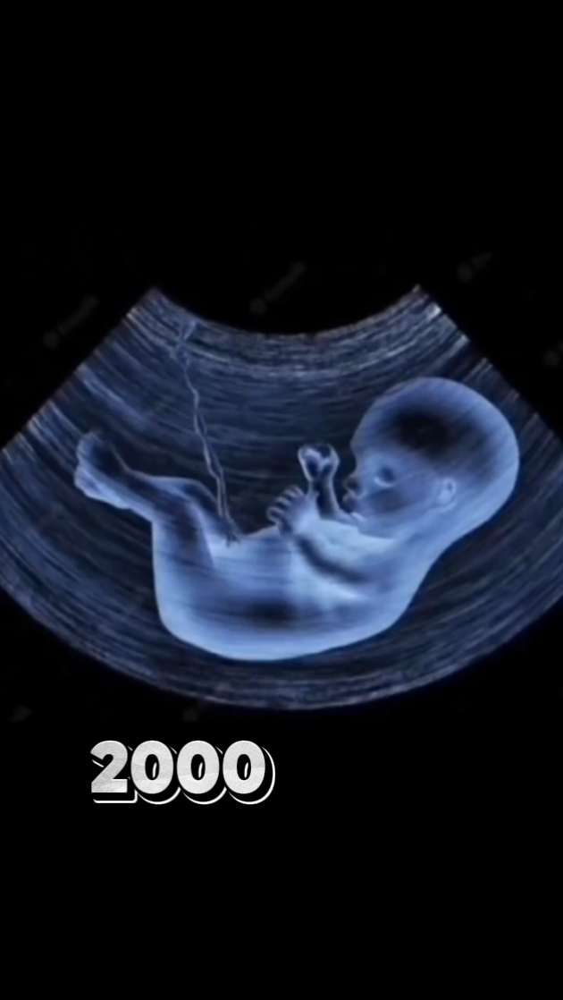 2000 US 2024