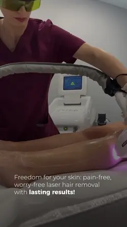 Hair removal laser