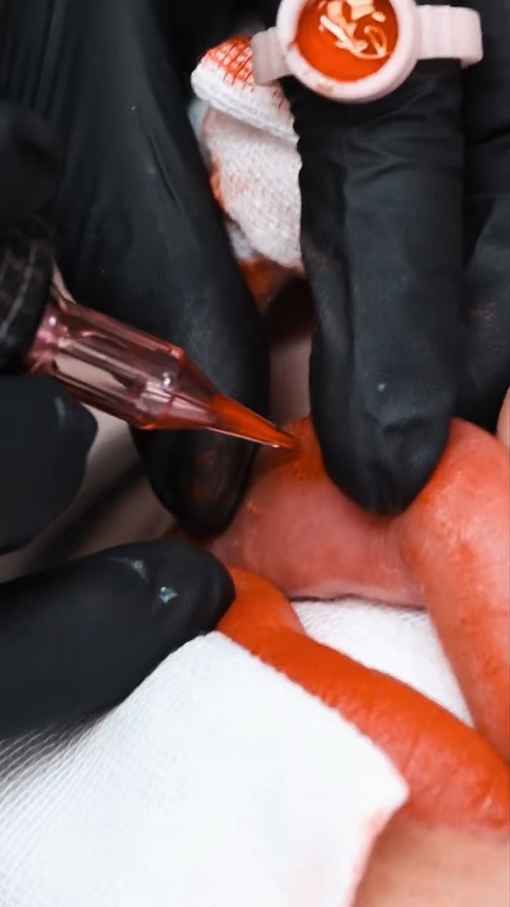 Lip filler