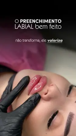 Lábios  Estetica