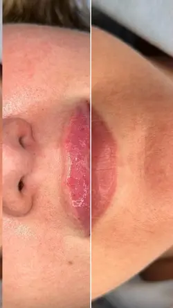 Antes e depois