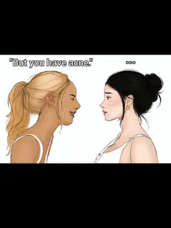 u have acne