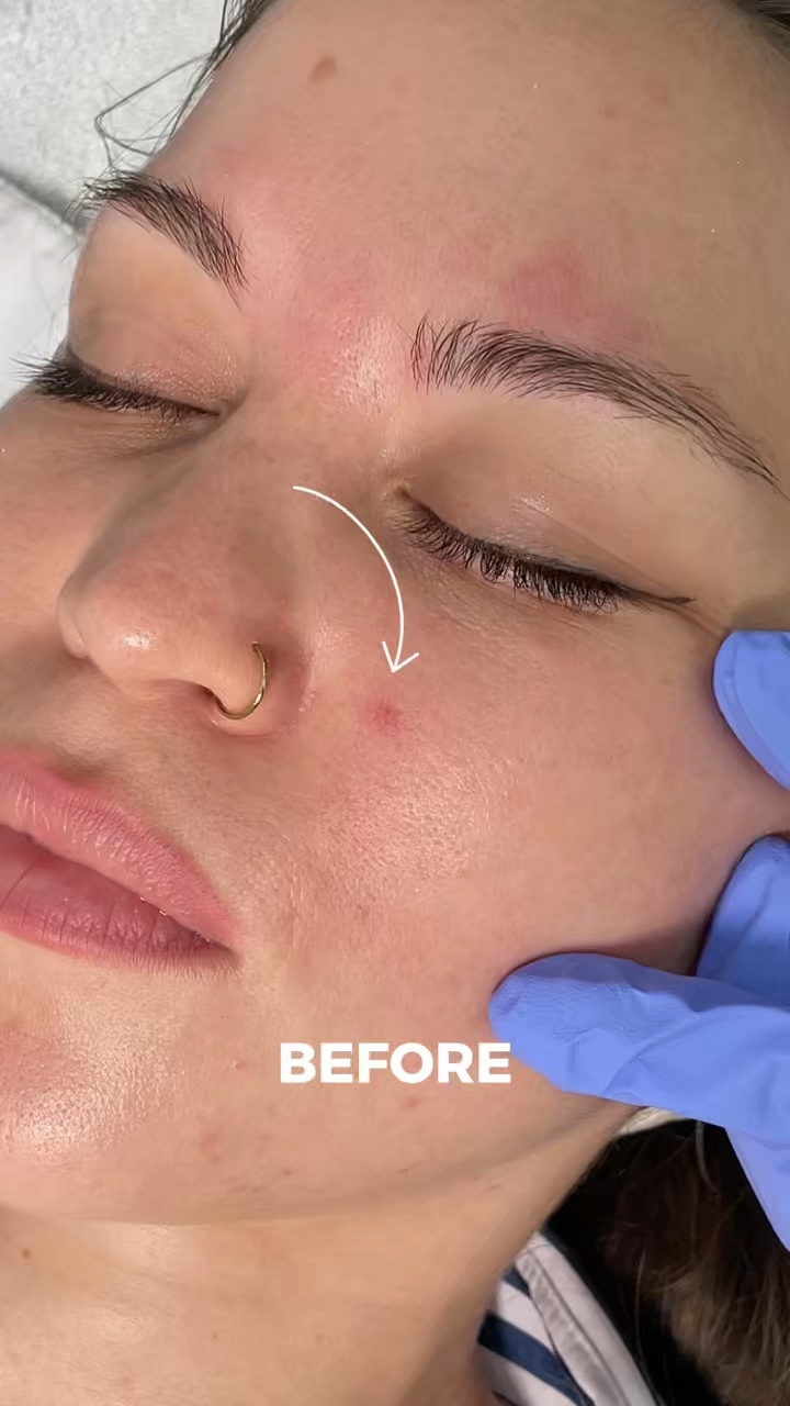 clinic before&after