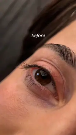 BEFOREVSAFTER