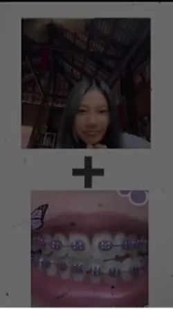 ពំពុងល្បី🩷🩷