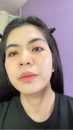 คอนแทคเลนส์