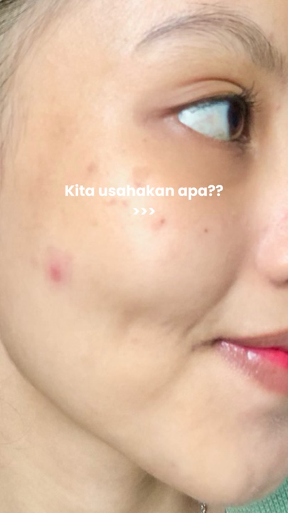 Ulasan Perawatan Kulit‼️
