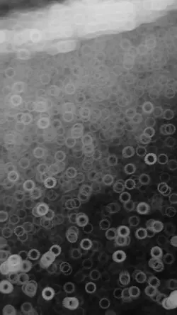 Viral