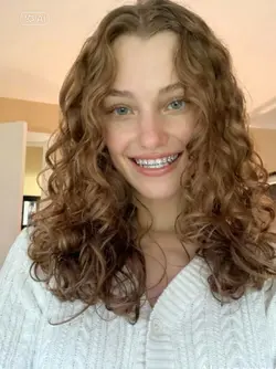 Ai gives you braces 