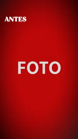antes e depois 