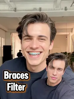 Braces Filter