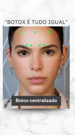 Botox