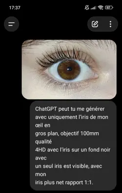 iris œil 