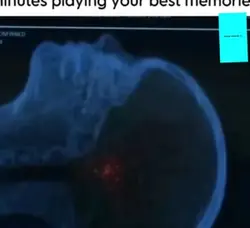 New viral trend