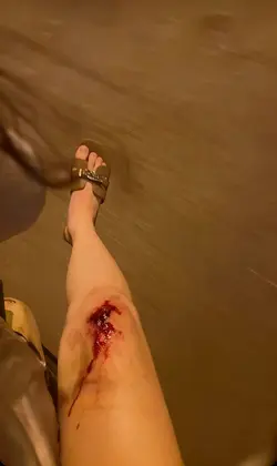 INJURY effect ai 