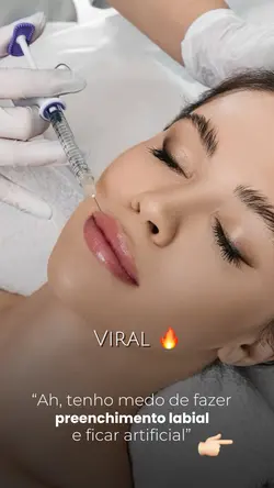 Antes Depois Labial