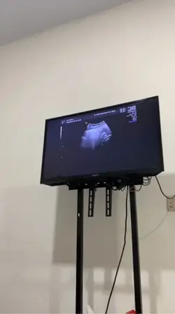 video usg