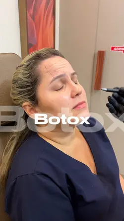 Botox 