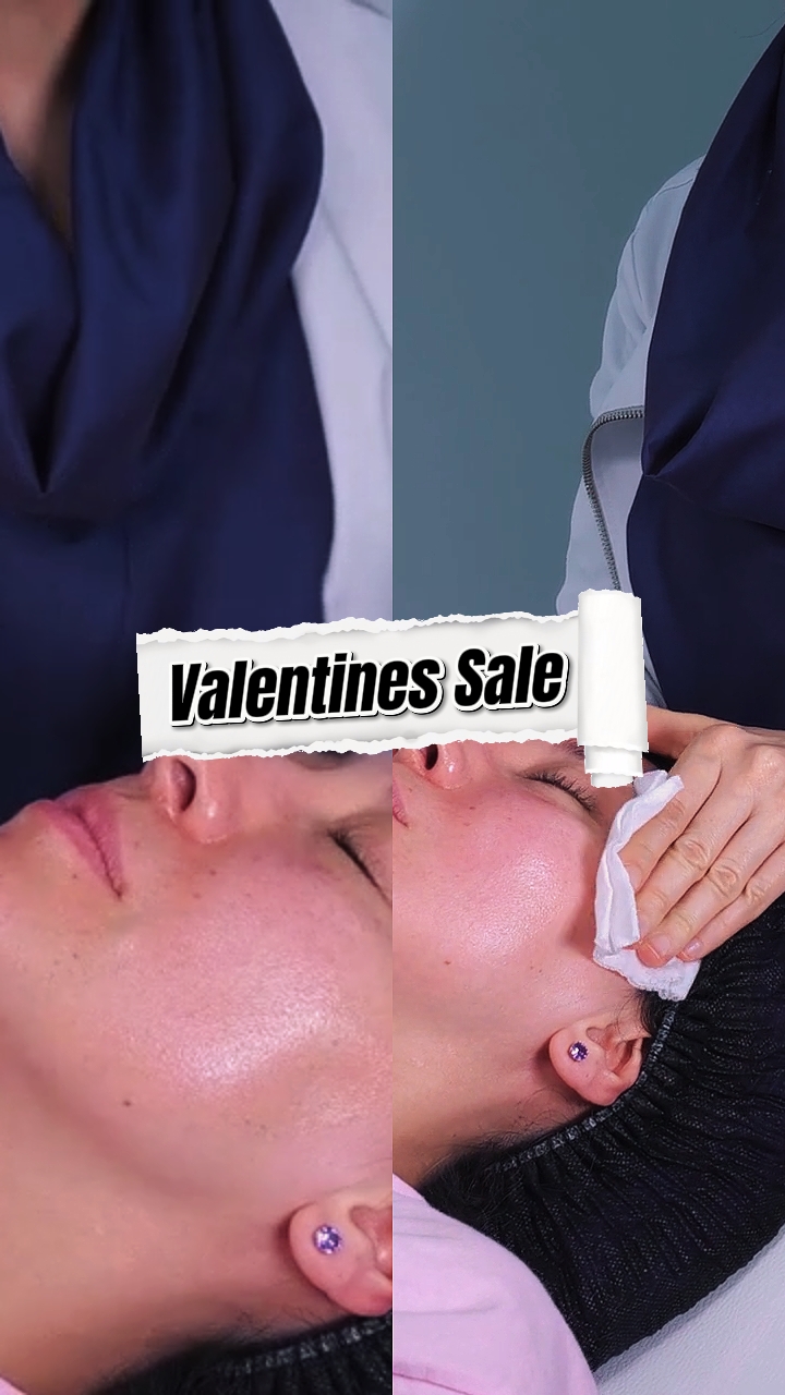 Venta de San Valentín