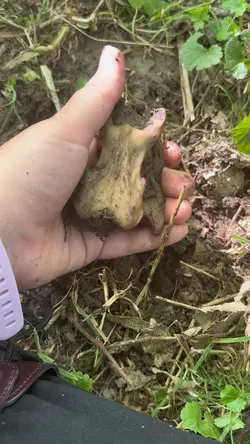 Bone collection