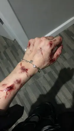 ai prank wounds