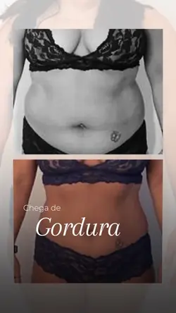Estética corporal