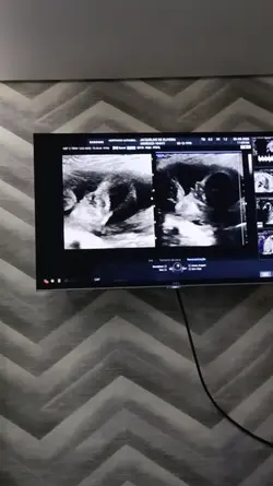 Eu precisava de você